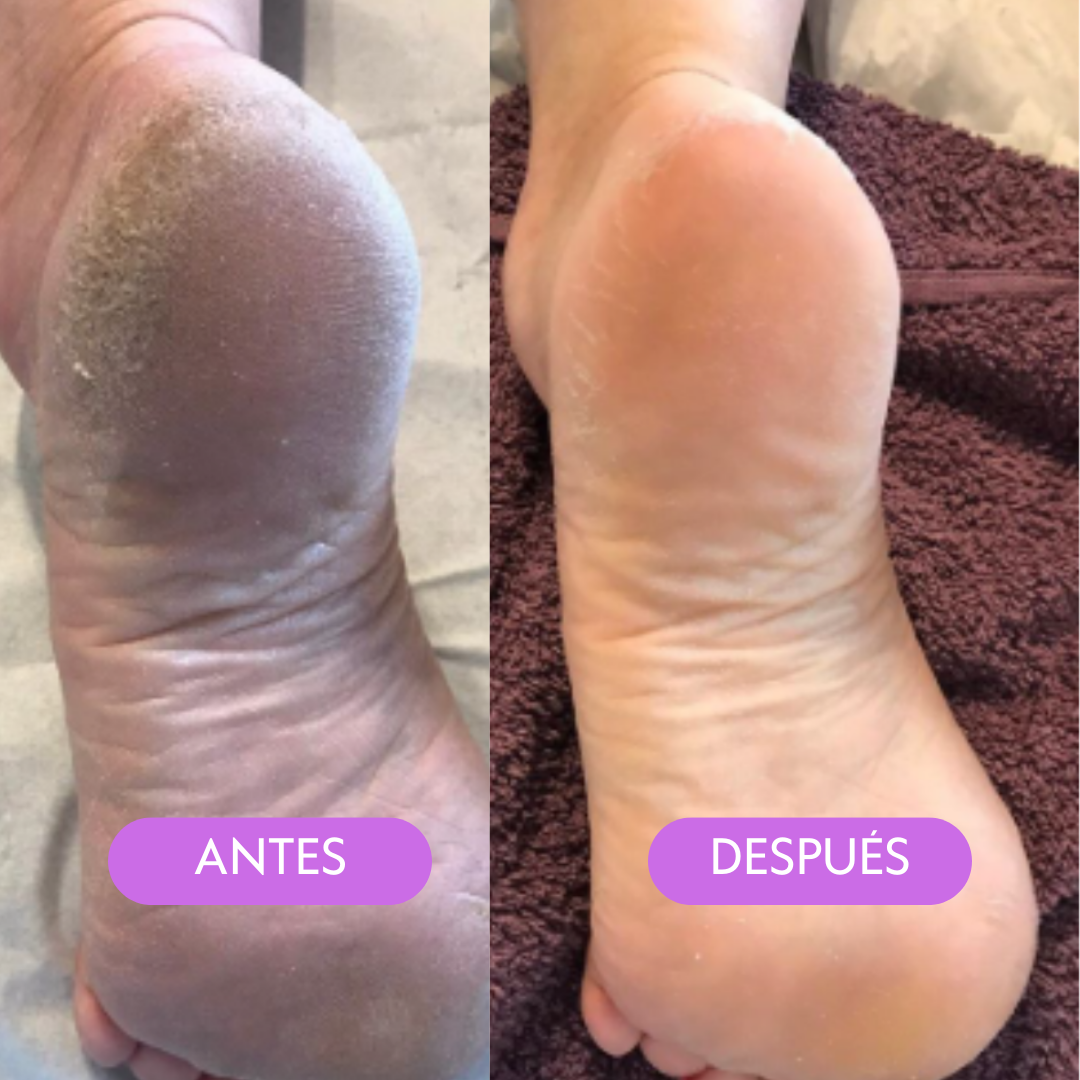 Cuidado para pies
